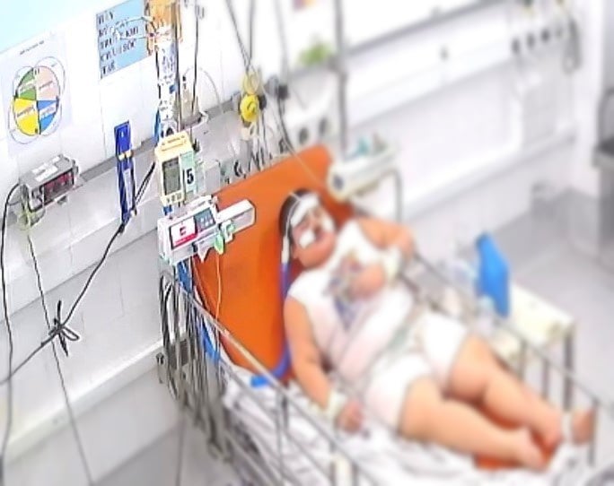 5 trẻ béo phì mắc COVID-19 nặng được điều trị thành công - Ảnh 1. 5 trẻ béo phì mắc COVID-19 nặng được điều trị thành công - Ảnh 1.
