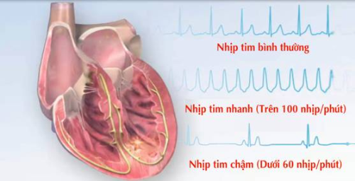 Chuyên gia chỉ ra những ảnh hưởng đến tim mạch sau nhiễm COVID-19 - Ảnh 4.